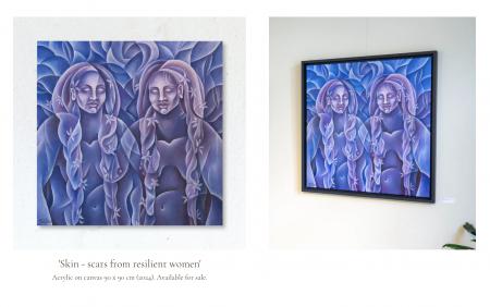  "Skin - scars from resilient women"